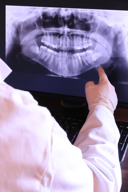 Best Emergency Dental Care for Broken or Chipped Teeth in Pleasant Valley, WV